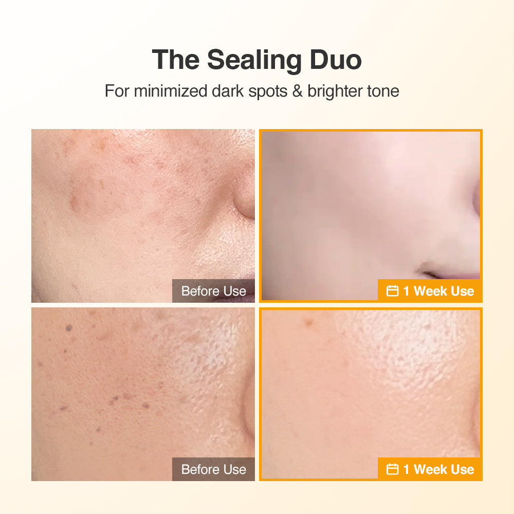 The Sealing Duo – Dr.Wandel US