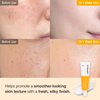 Rein Haut Wrapping Mask